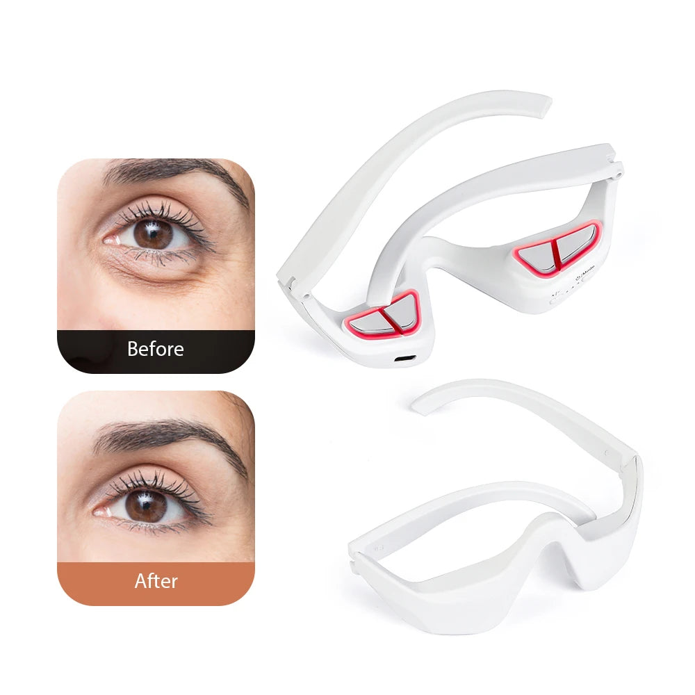 Eye Relax Pro – Anti Dark Circles & Fine Line Care